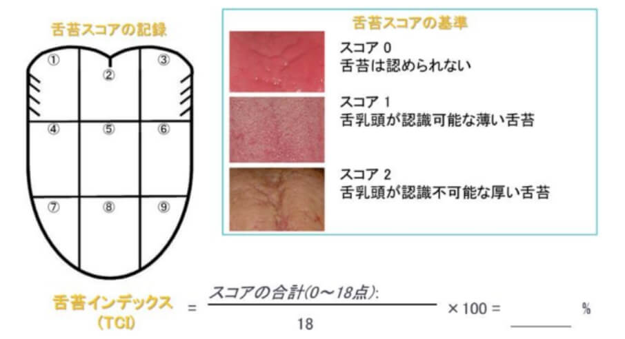 舌苔付着度の評価法 (TCI)の画像