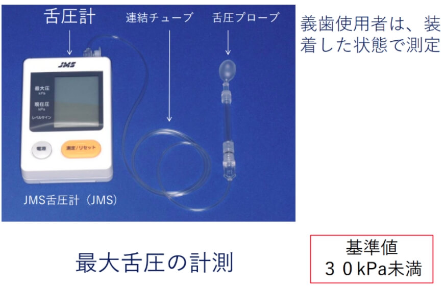 低舌圧の評価法の画像